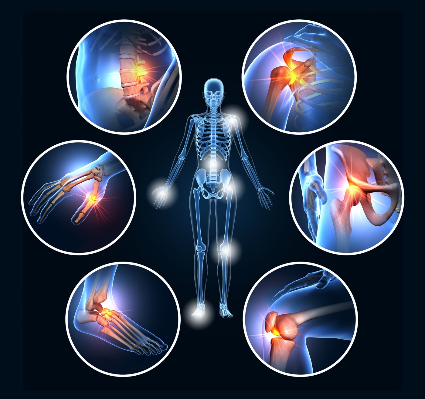 Body diagram highlighting shoulder, elbow, back, hip, knee and foot pain areas